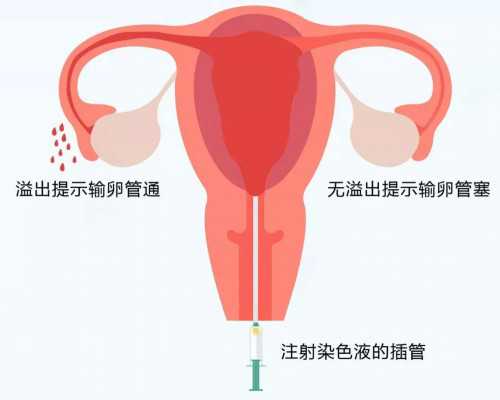 上海做试管助孕的医院有哪些好？,上海试管助孕成功率如何？?