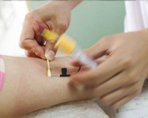 有没有必要去上海做试管