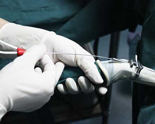 如何判断胎位正不正？