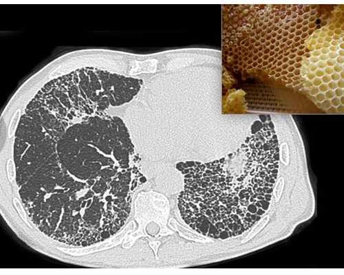 怀孕的症状 一个月_备孕休息时间计划表,北京排名最好的供卵机构有哪些，18家