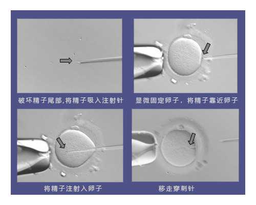 上海试管代怀生殖,上海仁济医院试管费用多少？试管成功率真的很高吗？