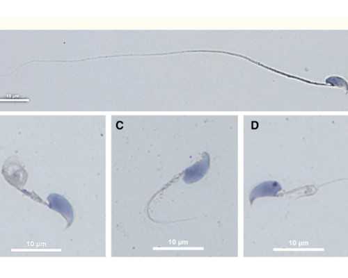 怎样制作手抄报方框？完美的手抄报技巧分享！