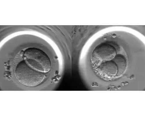 怀孕多久有反应恶心_育儿保姆的工作职责,无痛分娩对助孕有影响吗？