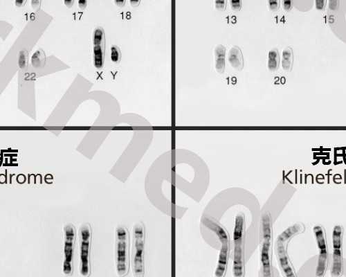 完达山奶粉好不好（消费者对完达山奶粉的介绍和反馈）