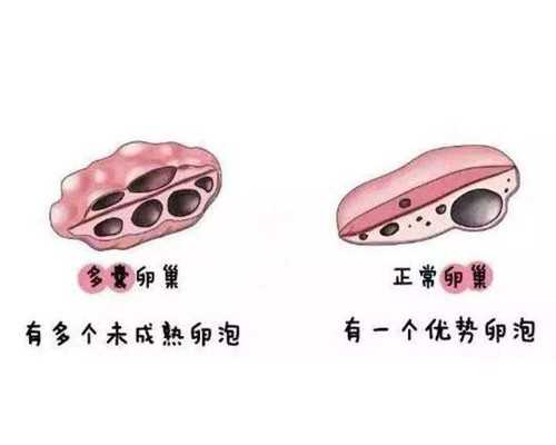 上海有代生吗,北京供卵代孕婴儿医院哪家好 供卵代孕婴儿生双胞胎可行吗_上海