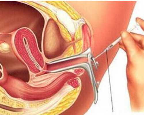 备孕期间老公感冒_怀孕初期出血褐色,女性子宫内膜薄备孕怎么补雌激素？饮食