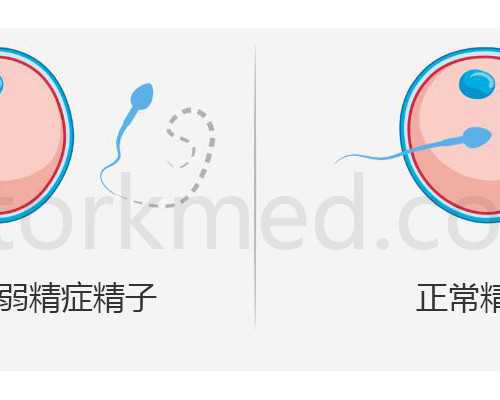上海代怀咨询网,上海供卵生子费用,供卵代孕婴儿男方精子条件男性精子要符合