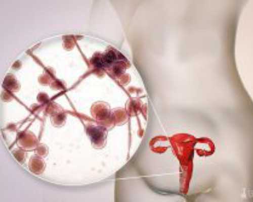 早衰想供实在是等不起，找了不排队的