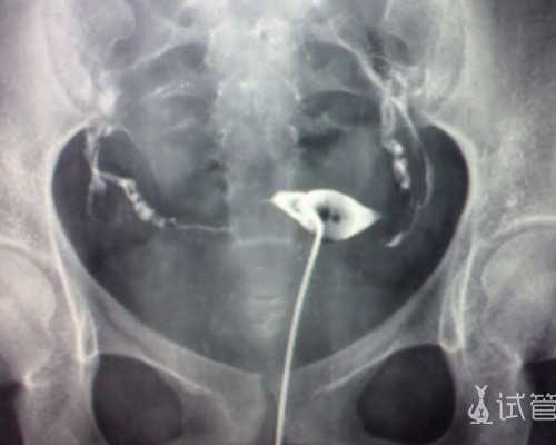 上海不育做试管,做试管促排卵能同房吗_上海供卵试管公司有哪些_私人医院做试