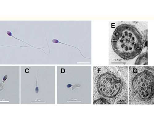 试管婴儿会不会不健康？没有结婚证可以做吗？