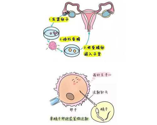 上海代怀供卵代孕&上海供卵平台排名,甲减有哪些症状，甲减对供卵代孕婴儿的