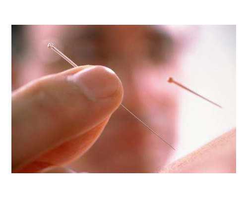 为什么备孕要三个月_育儿知识百科全书,刚刚，港股基因检测NGS第一股诞生：专