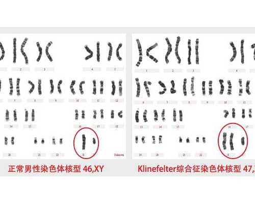 上海医院代怀过程,2026年上海集爱和九院哪个试管生男女技术更好？