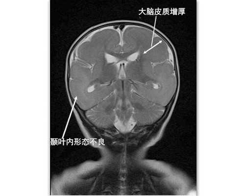 上海医院排队供卵,上海备孕保胎生排名_上海供卵试管生子多少钱_马鞍形子宫试