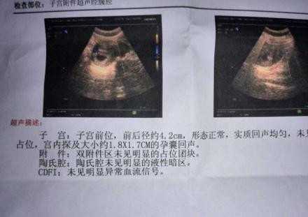 北京成功宝贝助孕公司：七天能不能测出代孕