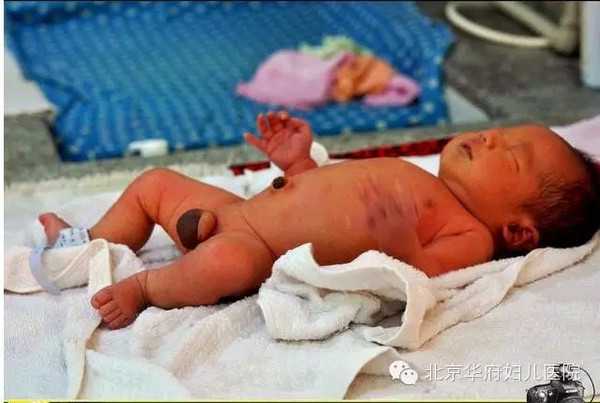 上海代孕准备多少钱_上海有谁在找代孕成功的_东方辅助生殖集团-二胎入盆晚吗