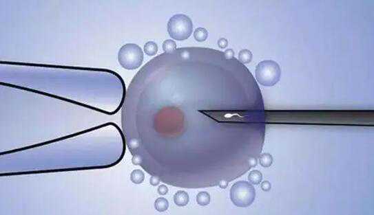 鲜胚质量一般达到几级才移植？