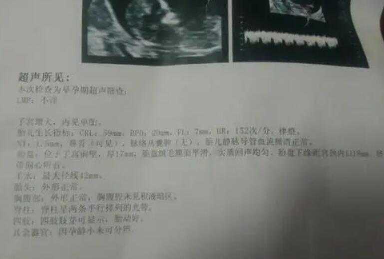 上海医院可以借卵生子 上海九院做试管婴儿的费用多少? ‘生男孩和生女孩有什
