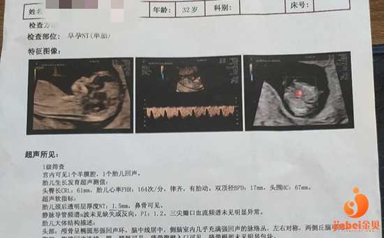 广州传承生殖中心成功案例[哪家供卵公司好]+我的试管心路历程，试管婴儿终于