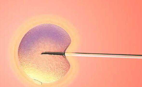 一代试管会把畸形精子删除挑出A级精子吗？