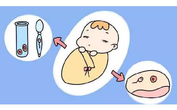 单卵双胎减胎能只减其中一个不影响另一个吗？_3I0z2