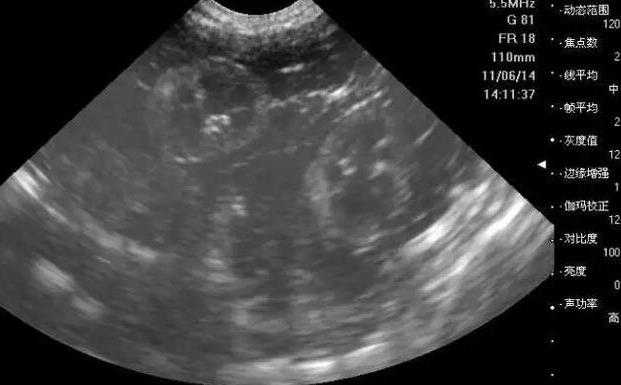 孕1-40周胎儿发育过程图是怎么样的？
